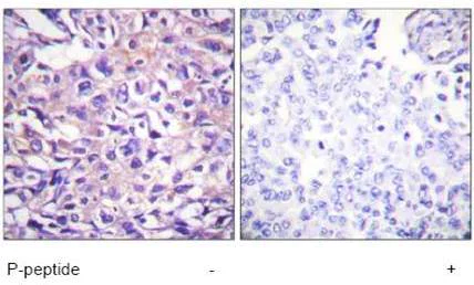 Immunohistochemistry (Formalin/PFA-fixed paraffin-embedded sections) - Anti-Myosin Phosphatase (phospho T696) antibody (AB59202)
