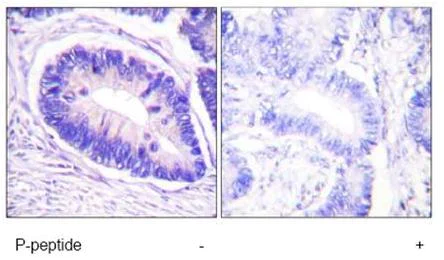 Immunohistochemistry (Formalin/PFA-fixed paraffin-embedded sections) - Anti-Myosin Phosphatase (phospho T853) antibody (AB59203)