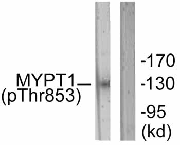 Western blot - Anti-Myosin Phosphatase (phospho T853) antibody (AB59203), expandable thumbnail