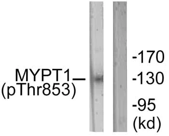 Western blot - Anti-Myosin Phosphatase (phospho T853) antibody (AB59203)