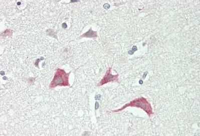 Immunohistochemistry (Formalin/PFA-fixed paraffin-embedded sections) - Anti-Myosin VIIa/MYO7A antibody (AB230631)