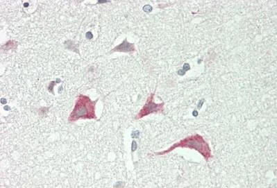 Immunohistochemistry (Formalin/PFA-fixed paraffin-embedded sections) - Anti-Myosin VIIa/MYO7A antibody (AB230631)