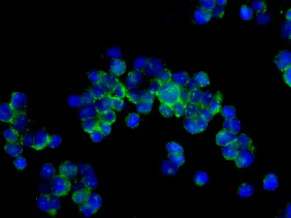 Immunocytochemistry/ Immunofluorescence - Anti-Myosin VIIa/MYO7A antibody [EPR7497] - BSA and Azide free (AB248957)