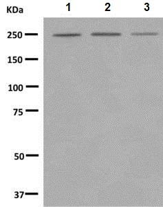 Western blot - Anti-Myosin VIIa/MYO7A antibody [EPR7497] - BSA and Azide free (AB248957)