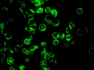 Immunocytochemistry/ Immunofluorescence - Anti-Myosin VIIa/MYO7A antibody [EPR7498] - BSA and Azide free (AB249229)