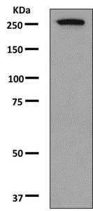 Western blot - Anti-Myosin VIIa/MYO7A antibody [EPR7498] - BSA and Azide free (AB249229)