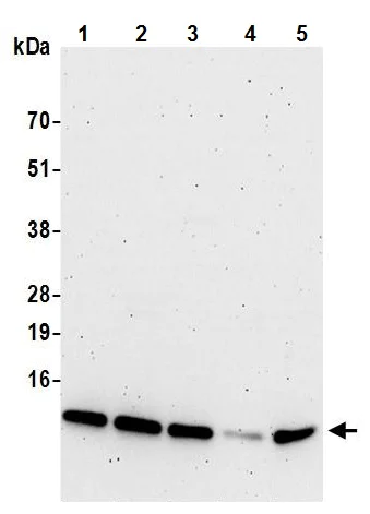 Western blot - Anti-Myotrophin antibody (AB241982)
