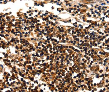 Immunohistochemistry (Formalin/PFA-fixed paraffin-embedded sections) - Anti-Myozenin 1 antibody (AB197660)