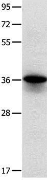 Western blot - Anti-Myozenin 1 antibody (AB197660)