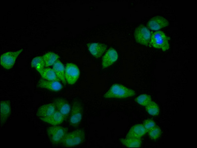 Immunocytochemistry/ Immunofluorescence - Anti-Myozenin 2 antibody (AB237053)