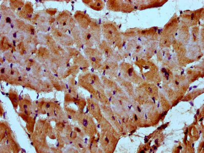 Immunohistochemistry (Formalin/PFA-fixed paraffin-embedded sections) - Anti-Myozenin 2 antibody (AB237053)