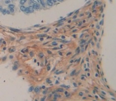 Immunohistochemistry (Formalin/PFA-fixed paraffin-embedded sections) - Anti-MYPN antibody (AB233039)