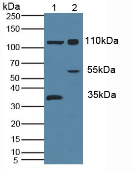 Western blot - Anti-MYPN antibody (AB233039)
