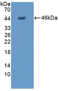 Western blot - Anti-MYPN antibody (AB233039)