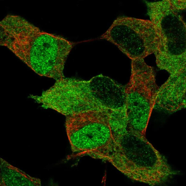 Immunocytochemistry/ Immunofluorescence - Anti-Myt1/MTF1 antibody (AB251682)