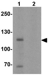 Western blot - Anti-MyT1L antibody (AB139732)