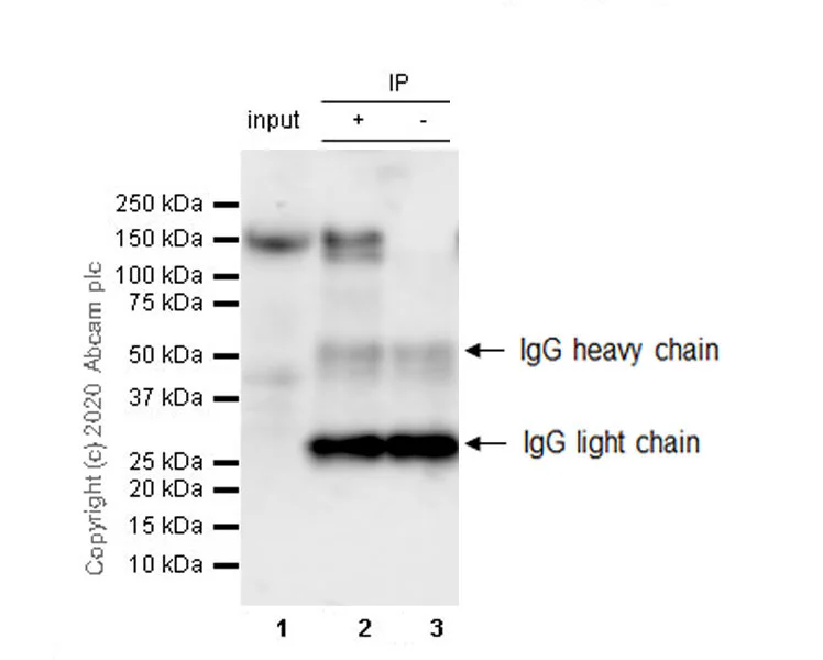 Immunoprecipitation - Anti-N-Cadherin/CD325 antibody [32/N-Cadherin] (AB280375)