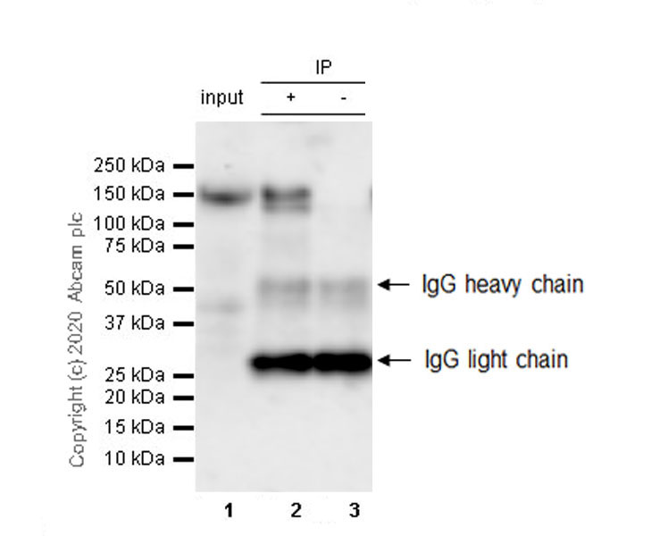 Immunoprecipitation - Anti-N Cadherin antibody [32/N-Cadherin] - BSA and Azide free (AB280380), expandable thumbnail