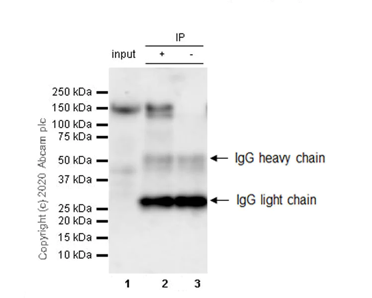 Immunoprecipitation - Anti-N Cadherin antibody [32/N-Cadherin] - BSA and Azide free (AB280380)
