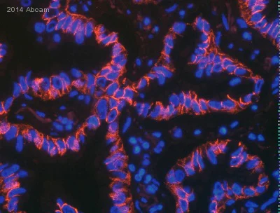Immunocytochemistry/ Immunofluorescence - Anti-N Cadherin antibody [5D5] - Intercellular Junction Marker (AB98952)