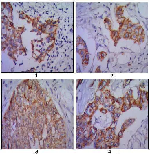 Immunohistochemistry (Formalin/PFA-fixed paraffin-embedded sections) - Anti-N Cadherin antibody [5D5] - Intercellular Junction Marker (AB98952)