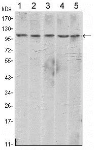 Western blot - Anti-N Cadherin antibody [5D5] - Intercellular Junction Marker (AB98952)