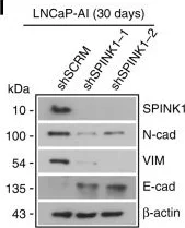 Western blot - Anti-N Cadherin antibody [5D5] - Intercellular Junction Marker (AB98952)