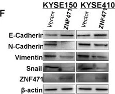 Western blot - Anti-N Cadherin antibody [5D5] - Intercellular Junction Marker (AB98952)
