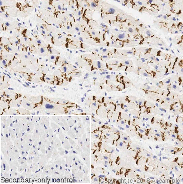 Immunohistochemistry (Formalin/PFA-fixed paraffin-embedded sections) - Anti-N Cadherin antibody [8C11] (AB19348)