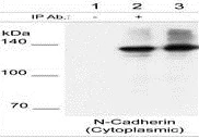Immunoprecipitation - Anti-N Cadherin antibody (AB76057)