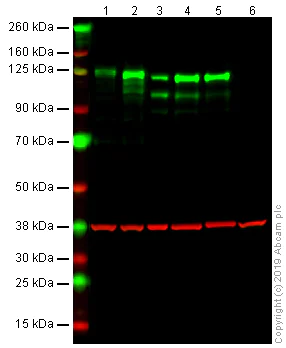 Western blot - Anti-N Cadherin antibody [EPR1791-4] (AB76011)