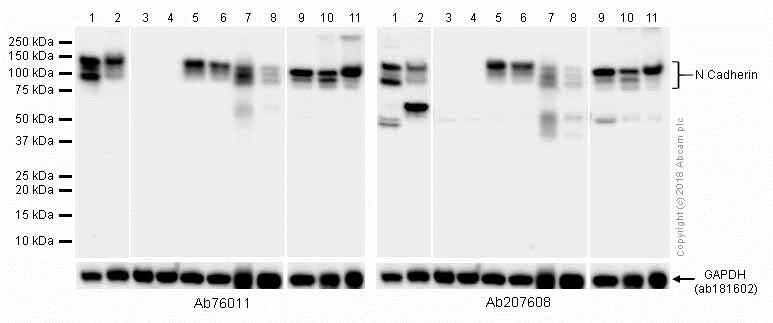 Western blot - Anti-N Cadherin antibody [EPR1791-4] (AB76011), expandable thumbnail