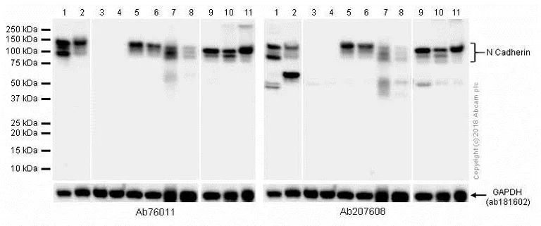 Western blot - Anti-N Cadherin antibody [EPR1791-4] (AB76011)
