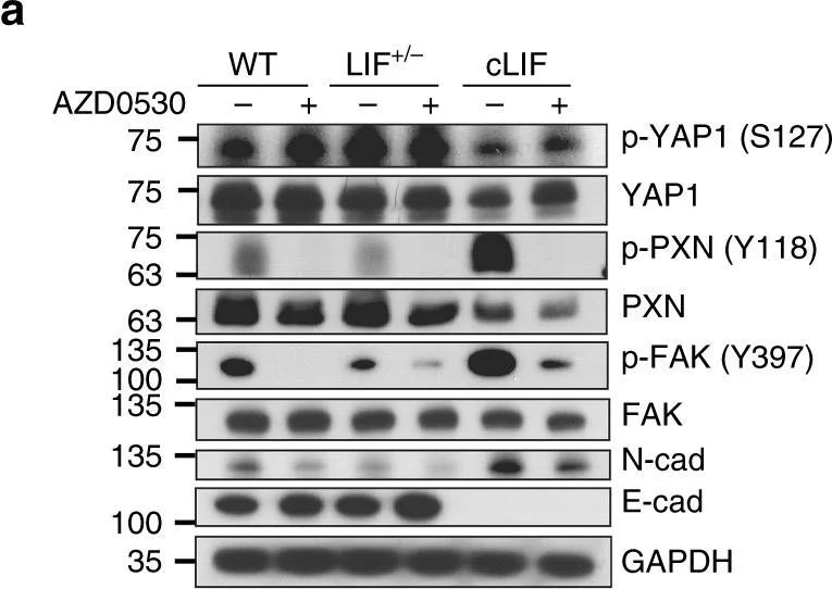Western blot - Anti-N Cadherin antibody [EPR1791-4] (AB76011)