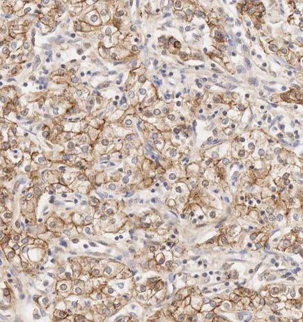 Immunohistochemistry (Formalin/PFA-fixed paraffin-embedded sections) - Anti-N Cadherin antibody [EPR1791-4] - BSA and Azide free (AB271856)