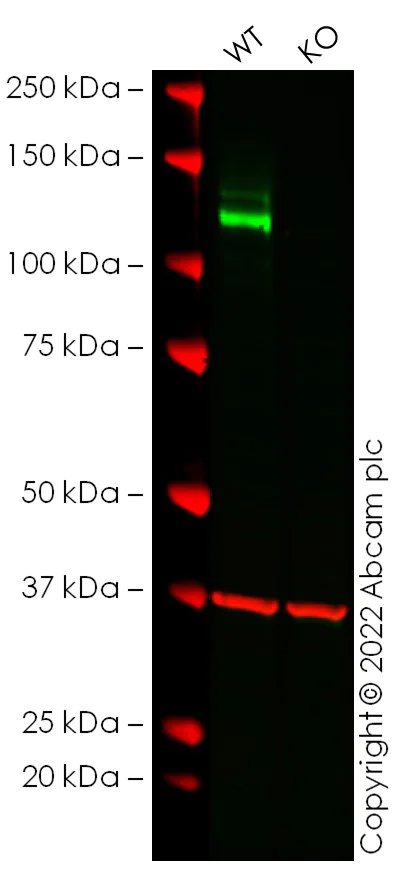 Western blot - Anti-N Cadherin antibody [EPR1791-4] - BSA and Azide free (AB271856)