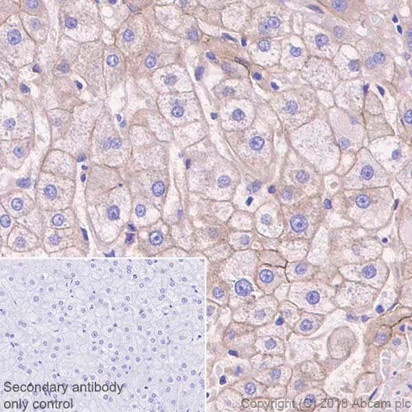 Immunohistochemistry (Formalin/PFA-fixed paraffin-embedded sections) - Anti-N Cadherin antibody [EPR1791-4] - Low endotoxin, Azide free (AB202030)