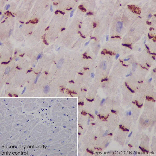Immunohistochemistry (Formalin/PFA-fixed paraffin-embedded sections) - Anti-N Cadherin antibody [EPR19654] (AB207608)