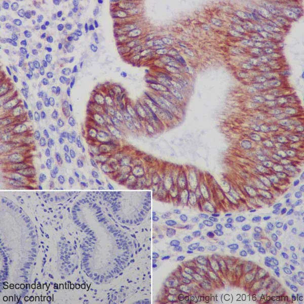 Immunohistochemistry (Formalin/PFA-fixed paraffin-embedded sections) - Anti-N Cadherin antibody [EPR19654] (AB207608)
