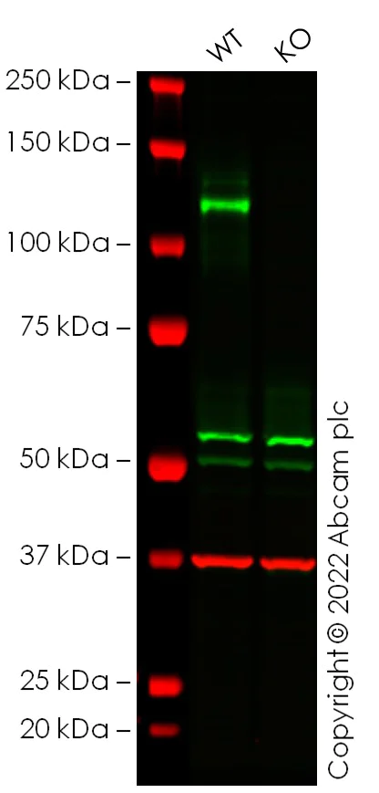 Western blot - Anti-N Cadherin antibody [EPR19654] - BSA and Azide free (AB236032)