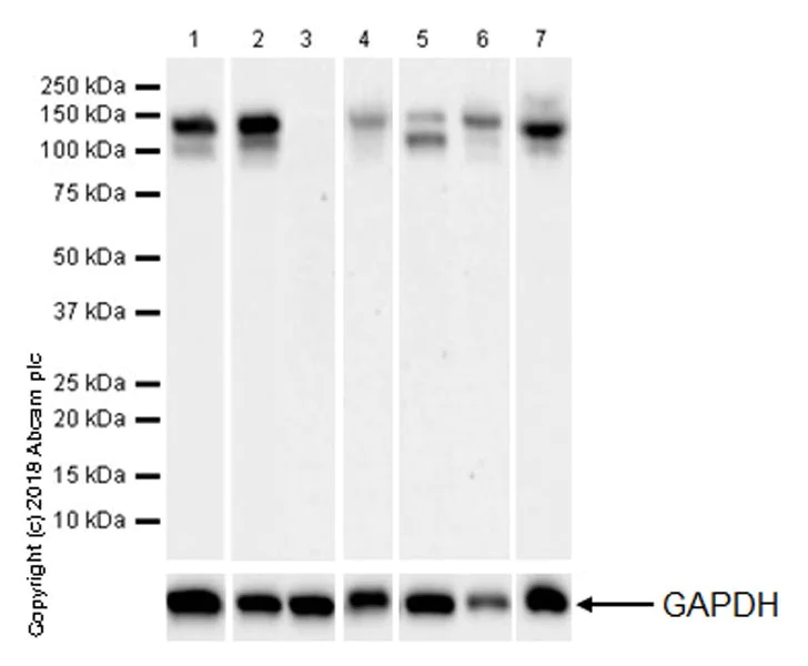 Western blot - Anti-N Cadherin antibody [EPR22397-264] (AB245117)