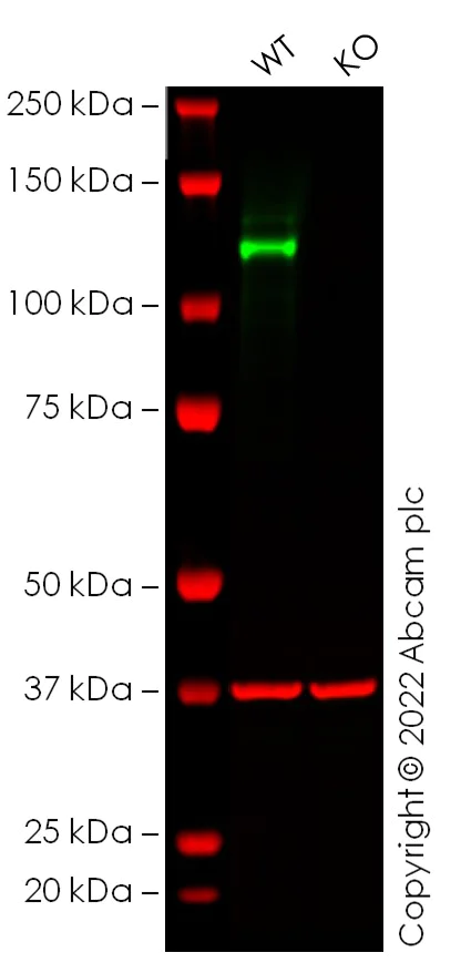 Western blot - Anti-N Cadherin antibody [EPR22397-264] - BSA and Azide free (AB245827)