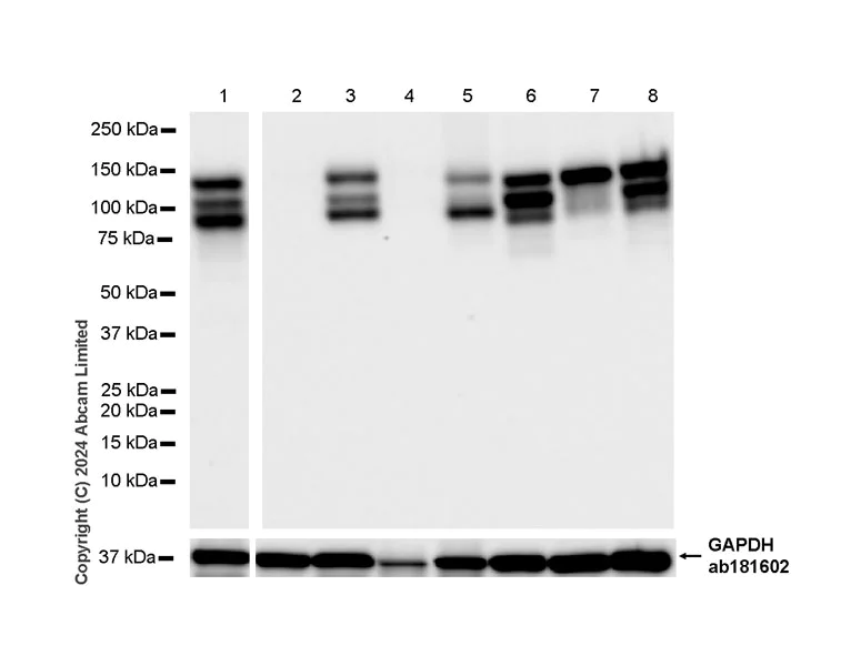 Western blot - Anti-N Cadherin antibody [EPR29626-10] (AB321897)