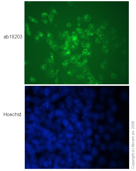 Immunocytochemistry/ Immunofluorescence - Anti-N Cadherin antibody - Intercellular Junction Marker (ab18203), expandable thumbnail