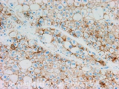 Immunohistochemistry (Formalin/PFA-fixed paraffin-embedded sections) - Anti-N Cadherin antibody - Intercellular Junction Marker (ab18203), expandable thumbnail
