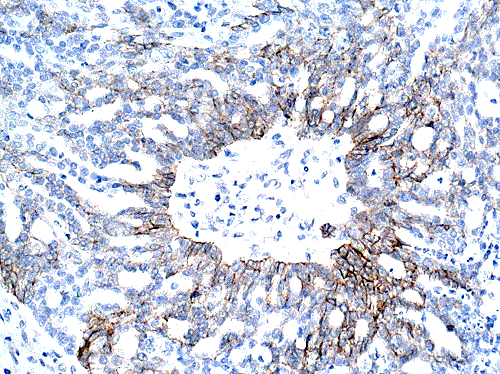Immunohistochemistry (Formalin/PFA-fixed paraffin-embedded sections) - Anti-N Cadherin antibody - Intercellular Junction Marker (AB18203), expandable thumbnail