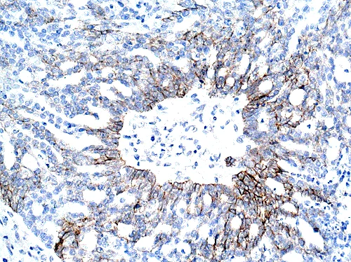 Immunohistochemistry (Formalin/PFA-fixed paraffin-embedded sections) - Anti-N Cadherin antibody - Intercellular Junction Marker (AB18203)