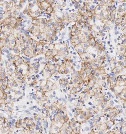 Immunohistochemistry (Formalin/PFA-fixed paraffin-embedded sections) - Anti-N Cadherin antibody - Intercellular Junction Marker (ab18203), expandable thumbnail