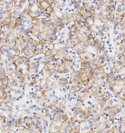Immunohistochemistry (Formalin/PFA-fixed paraffin-embedded sections) - Anti-N Cadherin antibody - Intercellular Junction Marker (AB18203)