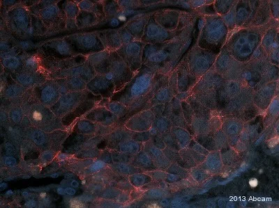 Immunohistochemistry (Formalin/PFA-fixed paraffin-embedded sections) - Anti-N Cadherin antibody - Intercellular Junction Marker (AB18203)